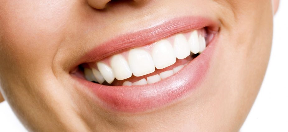 teeth whitening for crowned teeth